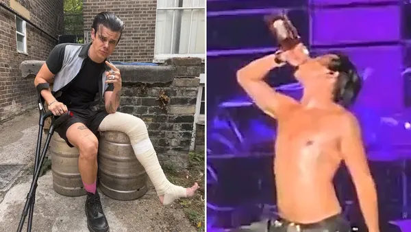 Yungblud Injures Leg in Dirt Bike Accident, Keeps Touring with Help of Jack Daniel’s
