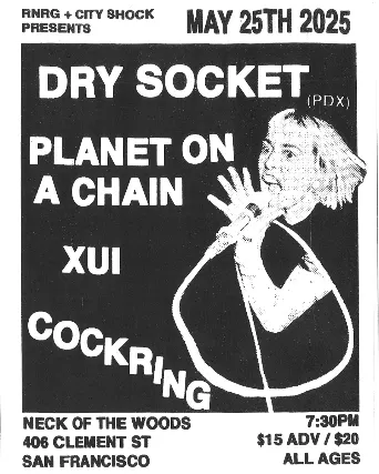 Dry Socket/ Planet on a Chain/ Xui/ Cockring